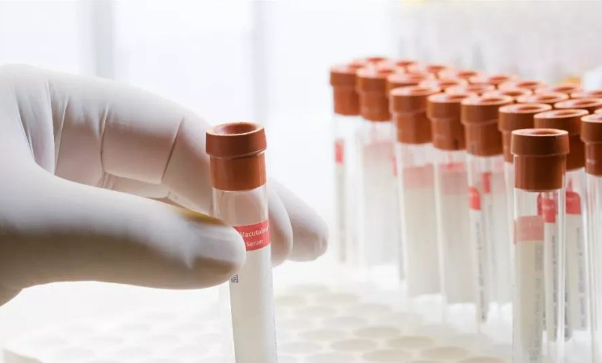 <a href=/ target=_blank class=infotextkey>临床试验</a>.PNG 临床试验.PNG