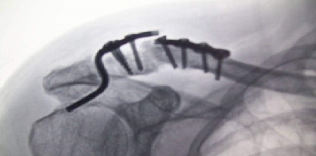 植入性医疗器械生产质量管理规范.jpg 植入性医疗器械生产质量管理规范.jpg