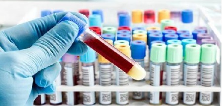 体外诊断试剂注册.jpg 体外诊断试剂注册.jpg