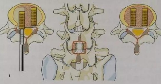 医疗器械注册.jpg 医疗器械注册.jpg