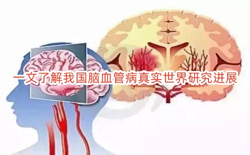 一文了解我国脑血管病真实世界研究进展