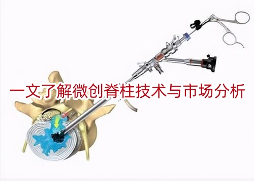 一文了解微创脊柱技术与市场分析