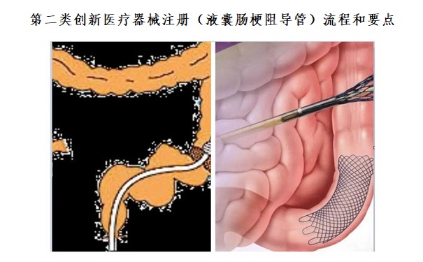 创新医疗器械注册.jpg 创新医疗器械注册.jpg