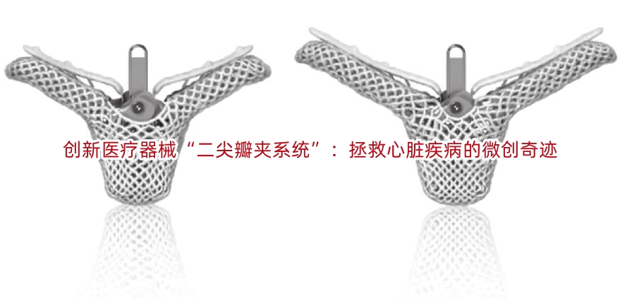 创新医疗器械“二尖瓣夹系统”:拯救心脏疾病的微创奇迹