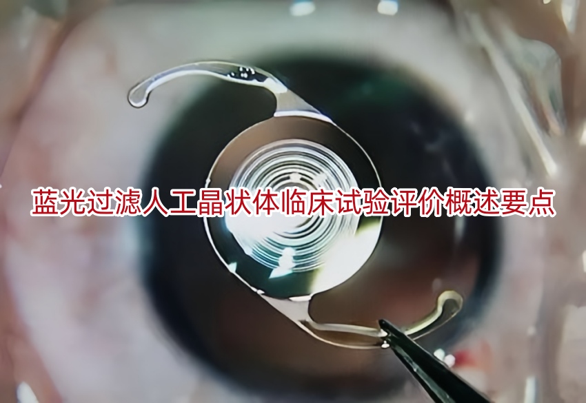 蓝光过滤人工晶状体<a href=/ target=_blank class=infotextkey>临床试验</a>评价概述要点
