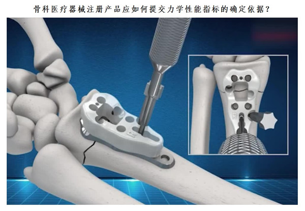 骨科医疗器械注册.jpg 骨科医疗器械注册.jpg