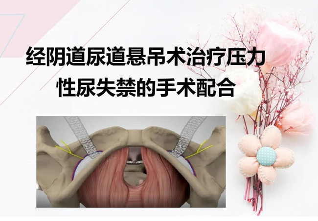 部分可吸收尿道悬吊带注册.jpg 部分可吸收尿道悬吊带注册.jpg