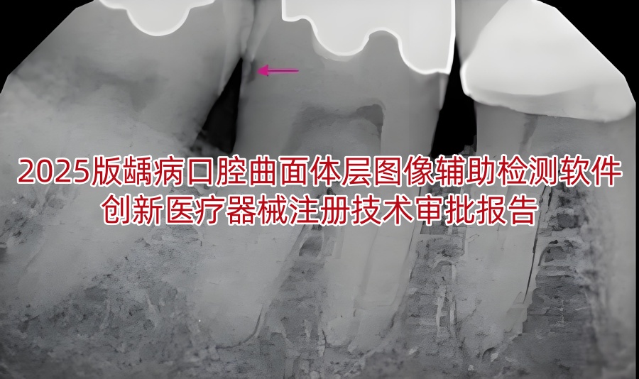 2025版龋病口腔曲面体层图像辅助检测软件创新<a href=/medical/ target=_blank class=infotextkey>医疗器械注册</a>技术审批报告