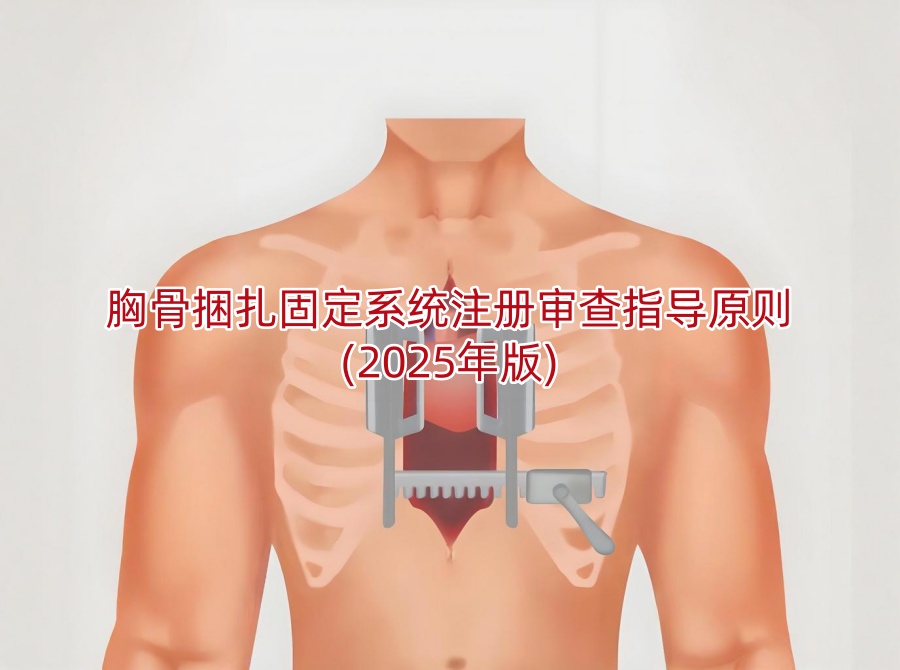 胸骨捆扎固定系统注册审查指导原则(2025年版)