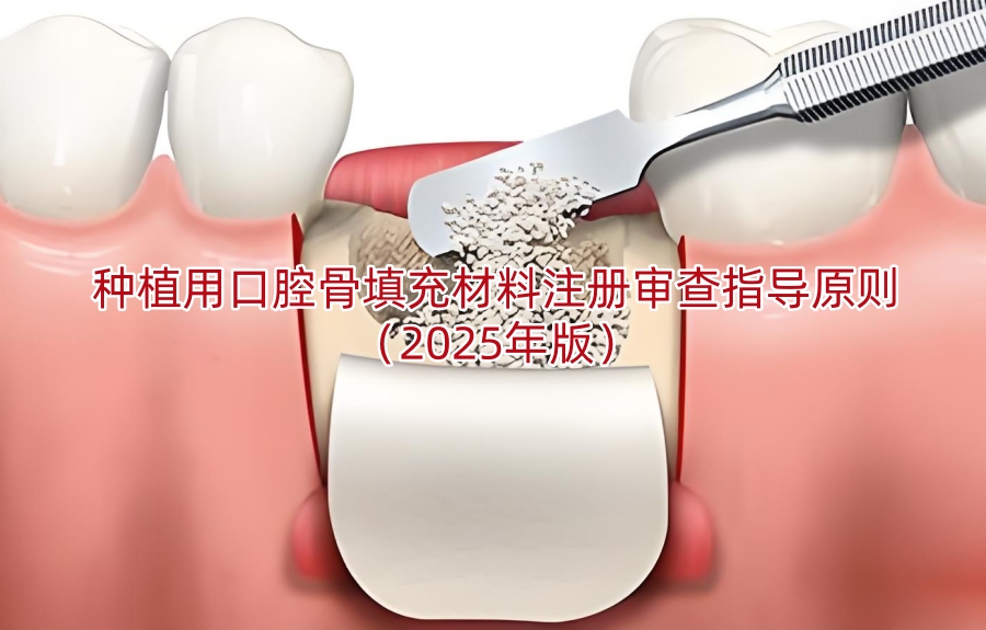 种植用口腔骨填充材料注册审查指导原则（2025年版）