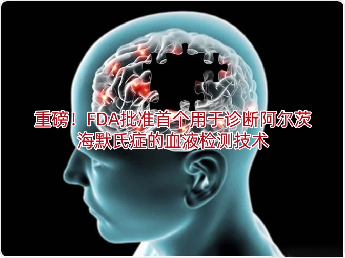 重磅!FDA批准首个用于诊断阿尔茨海默氏症的血液检测技术!