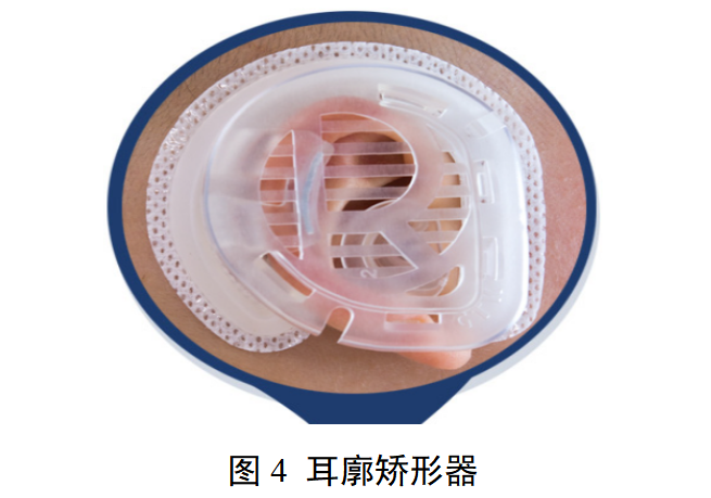 2025年矫形器产品注册审查指导原则 （送审稿）(图4)