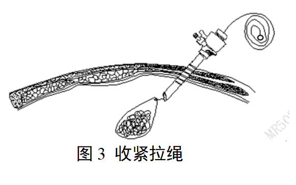 一次性使用内窥镜用活检袋注册审查指导原则（2025年最新版）(图3)