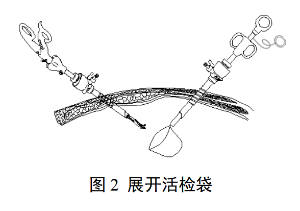 一次性使用内窥镜用活检袋注册审查指导原则（2025年最新版）(图2)