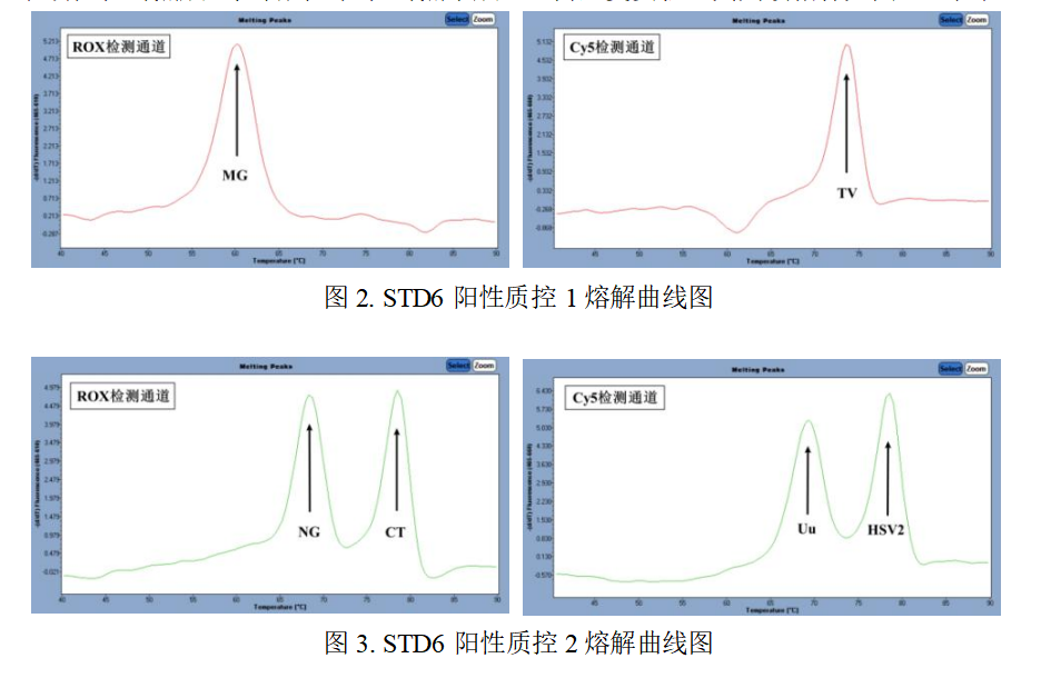 六项泌尿生殖系统感染病原体核酸检测试剂盒(荧光 PCR 法)说明书(图2)
