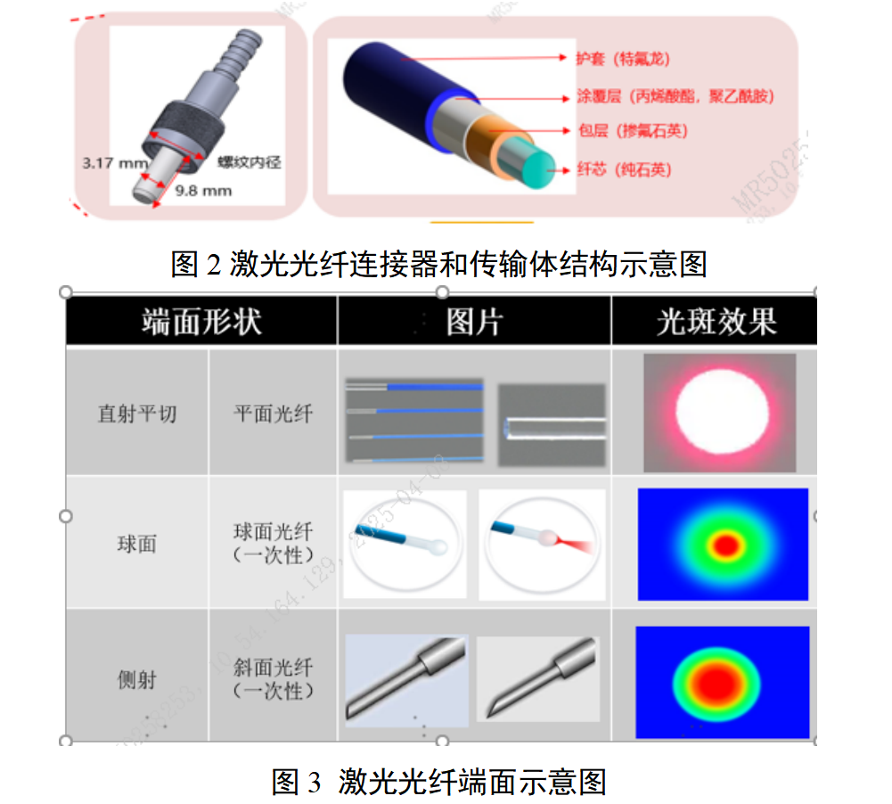 泌尿系统激光治疗设备注册审查指导原则（征求意见稿）(图2)