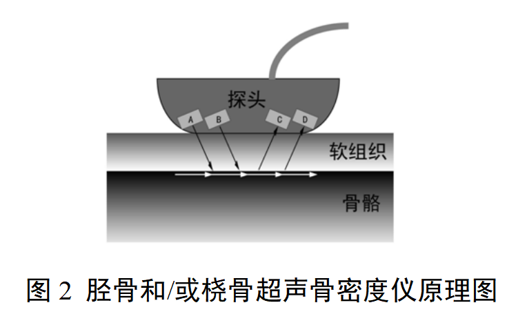 超声骨密度仪注册审查指导原则（2025年修订版）(图2)